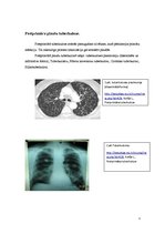 Konspekts 'Silikotuberkuloze', 3.