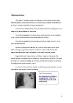 Konspekts 'Silikotuberkuloze', 5.