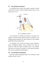 Referāts 'Asins pārliešana', 13.