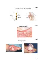Konspekts 'Podagras perēkļi nierēs', 10.
