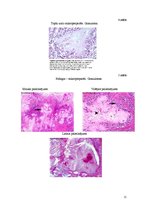 Konspekts 'Podagras perēkļi nierēs', 11.