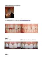 Referāts 'Zobu porcelāna restaurācijas pamatu iedalījums', 34.