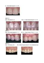 Referāts 'Zobu porcelāna restaurācijas pamatu iedalījums', 35.