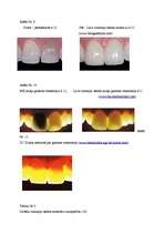Referāts 'Zobu porcelāna restaurācijas pamatu iedalījums', 36.