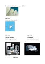 Referāts 'Zobu porcelāna restaurācijas pamatu iedalījums', 38.