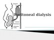 Prezentācija 'Peritoneal Dialysis', 1.