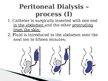 Prezentācija 'Peritoneal Dialysis', 5.