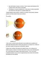 Referāts 'Redzes traucējumi', 2.