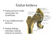 Prezentācija 'Iegurnis un gūžas locītava', 10.