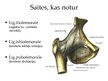 Prezentācija 'Iegurnis un gūžas locītava', 11.