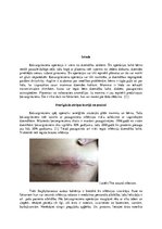 Referāts 'Infekciju riski un to novēršana dzemdībās ar ķeizargriezienu', 4.