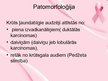 Prezentācija 'Krūts vēzis', 11.