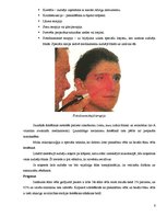 Konspekts 'Ādas ļaundabīgie audzēji', 4.