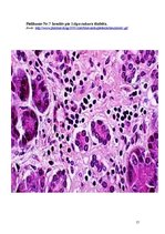 Referāts 'Pirmā tipa cukura diabēts', 17.