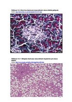 Referāts 'Pirmā tipa cukura diabēts', 18.