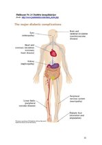 Referāts 'Pirmā tipa cukura diabēts', 22.