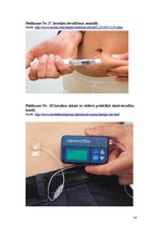 Referāts 'Pirmā tipa cukura diabēts', 24.