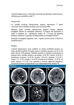 Konspekts 'CNS toksoplazmoze', 3.