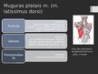 Prezentācija 'Rumpja muskuļi', 22.