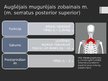 Prezentācija 'Rumpja muskuļi', 26.