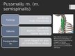 Prezentācija 'Rumpja muskuļi', 35.