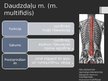Prezentācija 'Rumpja muskuļi', 36.