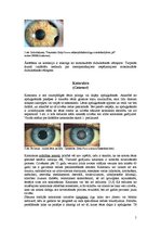 Referāts 'Monokulārā dubultošanās', 5.