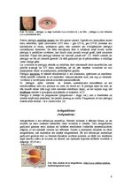 Referāts 'Monokulārā dubultošanās', 9.