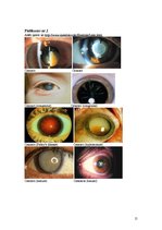 Referāts 'Monokulārā dubultošanās', 15.