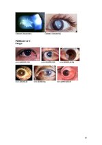 Referāts 'Monokulārā dubultošanās', 16.