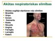 Referāts 'Akūtu respiratoru slimību ārstēšanas iespējas, izmantojot ārstniecības augus', 18.
