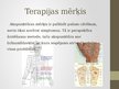 Prezentācija 'Akupunktūra', 5.