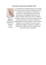 Referāts 'Kāpnes', 11.