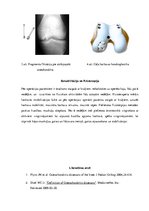 Referāts 'Osteohondritis dissecans jeb atslāņojošais osteohondrīts', 5.