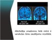 Prezentācija 'Alkohola iedarbība uz cilvēka organismu', 8.