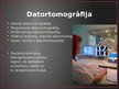 Prezentācija 'Rentgenstari, to pielietojums medicīnā', 10.