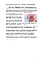 Konspekts 'Cilvēka ģenētika', 4.