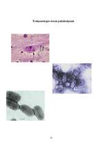 Referāts 'Trakumsērga', 16.