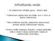 Prezentācija 'Tuberkuloze', 4.