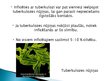 Prezentācija 'Tuberkuloze', 5.