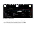 Prezentācija 'Mobilās sakaru sistēmas', 35.