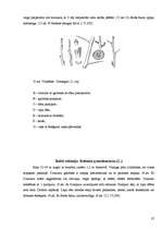 Referāts 'Koku un krūmu dzīve ziemā', 35.