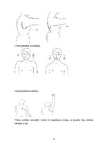 Referāts 'Kaulu lūzumi - viena no osteoporozes komplikācijām sievietēm pēc 45 gadiem', 20.