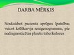 Prezentācija 'Pacienta aprūpe, veicot krūškurvja rentgenogrammu pie nediagnosticētas plaušu tu', 3.
