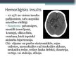 Prezentācija 'Hemorāģiskais insults. Insulta seku parādības', 8.