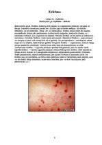 Referāts 'Ultravioletā starojuma iedarbība uz cilvēka ādu', 9.