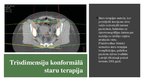 Prezentācija 'Staru terapija', 10.