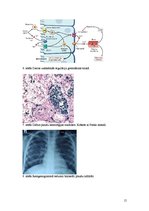 Referāts 'Hemosideroze', 15.