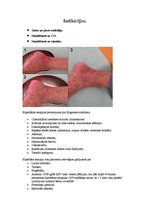 Referāts 'Hiperbāra terapija', 3.