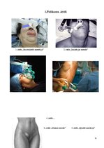 Referāts 'Anestēzijas veida ietekme uz pacienta atlabšanu pēcoperācijas periodā', 35.